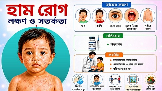 হাম রোগের লক্ষণ